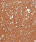 NCAM1 Antibody (C-term)